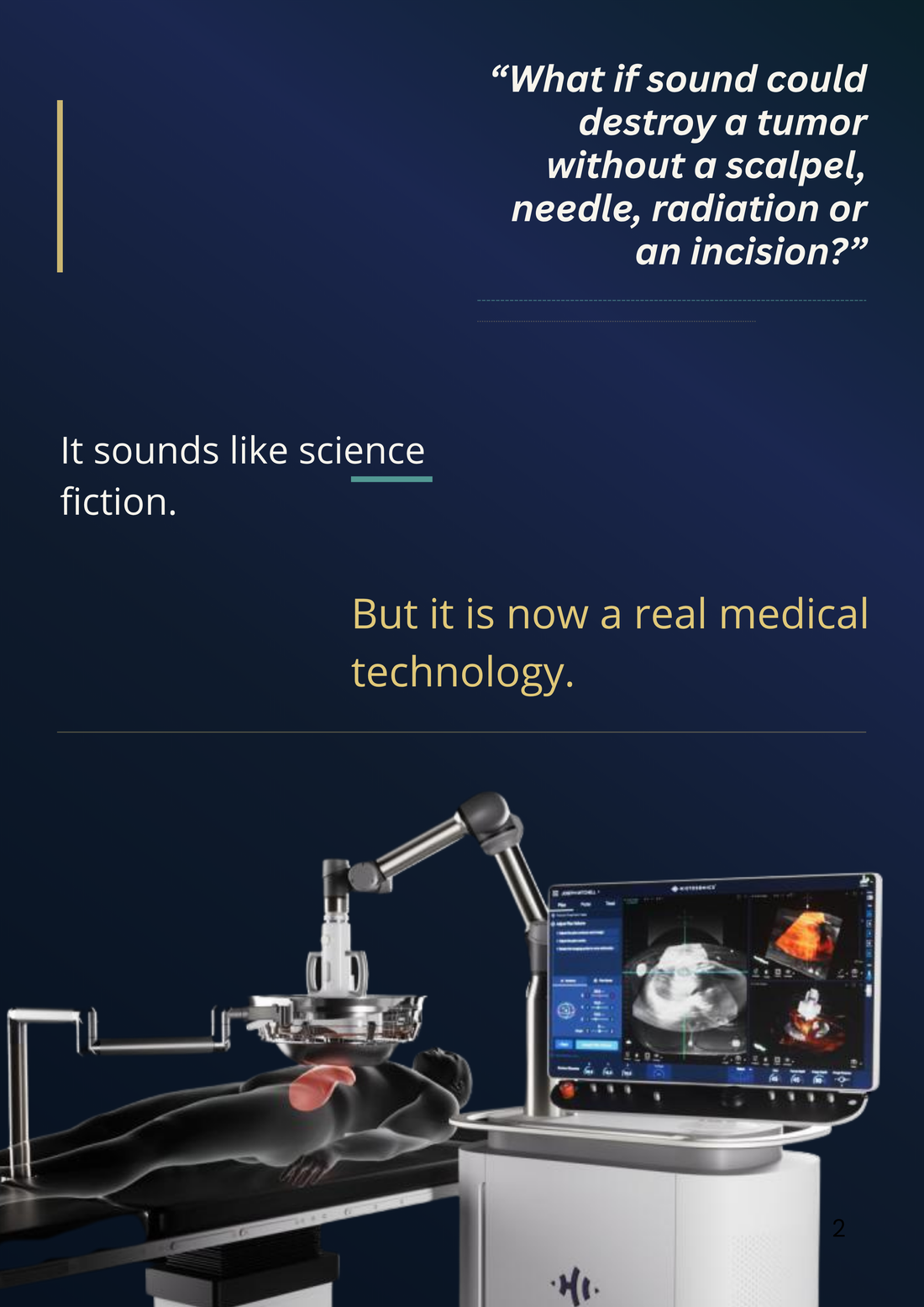 What if sound could destroy a tumor without a scalpel, needle, radiation or an incision? It sounds like science fiction, but it is now a real medical technology.